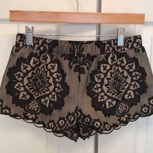 Dolce Vita Scalloped Hem Shorts